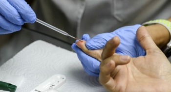 Número de novos casos de HIV em Goiânia tem queda de 10%